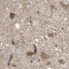Immunohistochemical staining of human cerebral cortex using Anti-CYB5R1 antibody HPA010641.