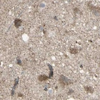 Immunohistochemical staining of human cerebral cortex using Anti-CYB5R1 antibody HPA010641.