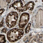 Immunohistochemical staining of human kidney using Anti-CYB5R1 antibody HPA010641.