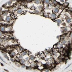 Immunohistochemical staining of human testis using Anti-CYB5R1 antibody HPA010641.