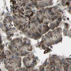 Immunohistochemical staining of human pancreas using Anti-CYB5R1 antibody HPA010641.