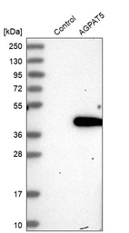 Western blot analysis in control (vector only transfected HEK293T lysate) and AGPAT5 over-expression lysate (Co-expressed with a C-terminal myc-DDK tag (~3.1 kDa) in mammalian HEK293T cells, LY413113).