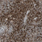 Anti-SAMSN1 Antibody