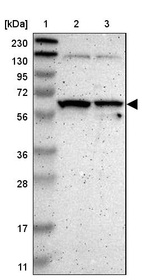 Lane 1: Marker [kDa] 230, 130, 95, 72, 56, 36, 28, 17, 11_br/_Lane 2: Human cell line RT-4_br/_Lane 3: Human cell line U-251MG sp