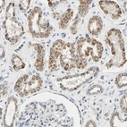 Immunohistochemical staining of human kidney shows moderate granular cytoplasmic positivity in cells in tubules.