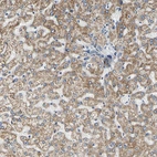 Immunohistochemical staining of human liver shows moderate granular cytoplasmic positivity in hepatocytes.