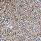 Immunohistochemical staining of human pancreas shows moderate granular cytoplasmic positivity in exocrine glandular cells.