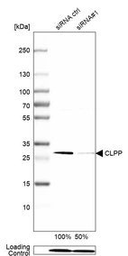 Western blot analysis in HEK293 cells transfected with control siRNA, target specific siRNA probe #1, using Anti-CLPP antibody. Remaining relative intensity is presented. Loading control: Anti-PPIB.