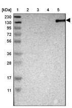 Lane 1: Marker [kDa] 230, 130, 95, 72, 56, 36, 28, 17, 11_br/_Lane 2: Human cell line RT-4_br/_Lane 3: Human cell line U-251MG sp_br/_Lane 4: Human plasma (IgG/HSA depleted)_br/_Lane 5: Human liver tissue