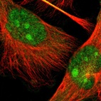 Immunofluorescent staining of human cell line U-251 MG shows localization to nucleus, nucleoli & cytosol.