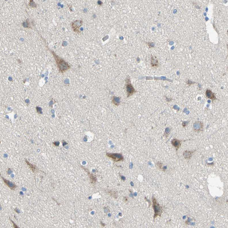 Anti-TMEM59L Antibody