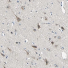 Anti-TMEM59L Antibody