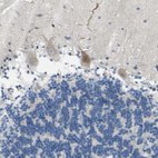 Immunohistochemical staining of human cerebellum shows moderate cytoplasm granular positivity in Purkinje cells.