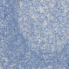 Immunohistochemical staining of human tonsil shows no cytoplasm granular positivity in germinal center cells as expected.