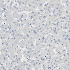 Immunohistochemical staining of human liver shows no cytoplasm granular 
 positivity in hepatocytes as expected.