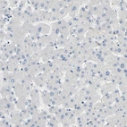 Immunohistochemical staining of human liver shows no cytoplasm granular 
 positivity in hepatocytes as expected.