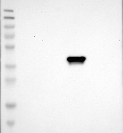 Anti-C1GALT1C1 Antibody