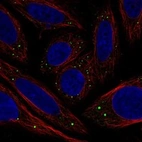 Immunofluorescent staining of human cell line SiHa shows localization to vesicles.