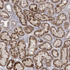 Immunohistochemical staining of human kidney shows strong granular cytoplasmic positivity in cells in tubules.