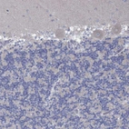 Immunohistochemical staining of human cerebellum shows no positivity in Purkinje cells as expected.