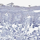 Immunohistochemical staining of human skin shows no positivity in squamous epithelial cells as expected.