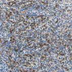 Anti-SIGLEC9 Antibody