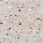 Anti-SIGLEC9 Antibody