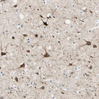 Immunohistochemical staining of human cerebral cortex shows strong cytoplasmic positivity in neurons.