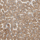 Anti-SIGLEC9 Antibody