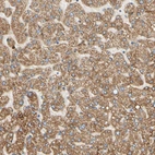Immunohistochemical staining of human liver shows moderate granular cytoplasmic positivity in hepatocytes.