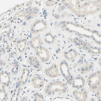 Anti-SIGLEC9 Antibody