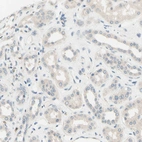 Immunohistochemical staining of human kidney shows no positivity in cells in tubules as expected.
