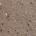 Anti-RHOT1 Antibody