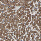 Immunohistochemical staining of human liver shows positivity in hepatocytes.