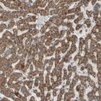 Immunohistochemical staining of human liver shows positivity in hepatocytes.