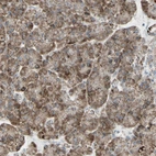 Immunohistochemical staining of human pancreas shows positivity in exocrine glandular cells.