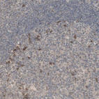 Immunohistochemical staining of human tonsil shows moderate cytoplasmic positivity in germinal center cells.