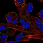 Immunofluorescent staining of human cell line RH-30 shows localization to plasma membrane.