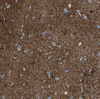 Immunohistochemical staining of human cerebral cortex shows strong positivity in neuropil.
