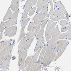 Immunohistochemical staining of human skeletal muscle shows no expression in myocytes as expected.