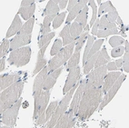 Immunohistochemical staining of human skeletal muscle shows no expression in myocytes as expected.