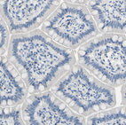 Immunohistochemical staining of small intestine shows no positivity in glandular cells as expected.