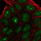 Immunofluorescent staining of human cell line RT4 shows localization to nucleus & nucleoli.