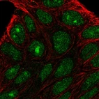 Immunofluorescent staining of human cell line RT4 shows localization to nucleus & nucleoli.