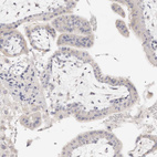 Immunohistochemical staining of human placenta shows no positivity in trophoblastic cells as expected.