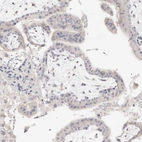 Immunohistochemical staining of human placenta shows no positivity in trophoblastic cells as expected.