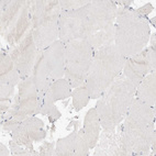 Immunohistochemical staining of human skeletal muscle shows no positivity in myocytes as expected.