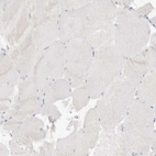 Immunohistochemical staining of human skeletal muscle shows no positivity in myocytes as expected.