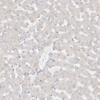 Immunohistochemical staining of human liver shows no positivity in hepatocytes as expected.