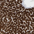 Anti-MGST2 Antibody